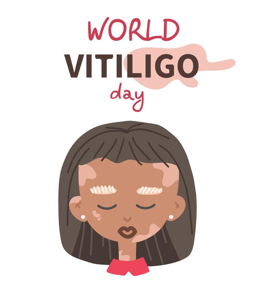 portret van een mooi met een donkere huid vrouw met vitiligo. lichaam positiviteit concept. liefde jezelf. banier voor Internationale vitiligo dag. vector