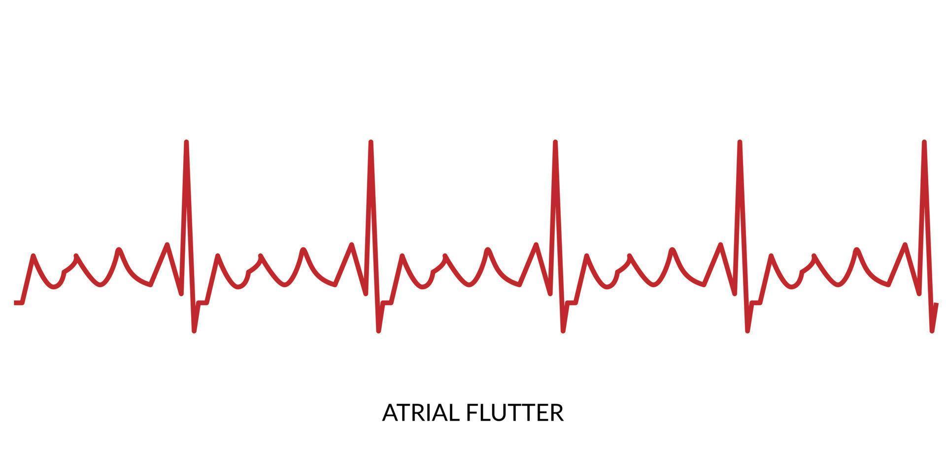 ecg hartslag lijn. elektrocardiogram vector illustratie. atriaal fladderen