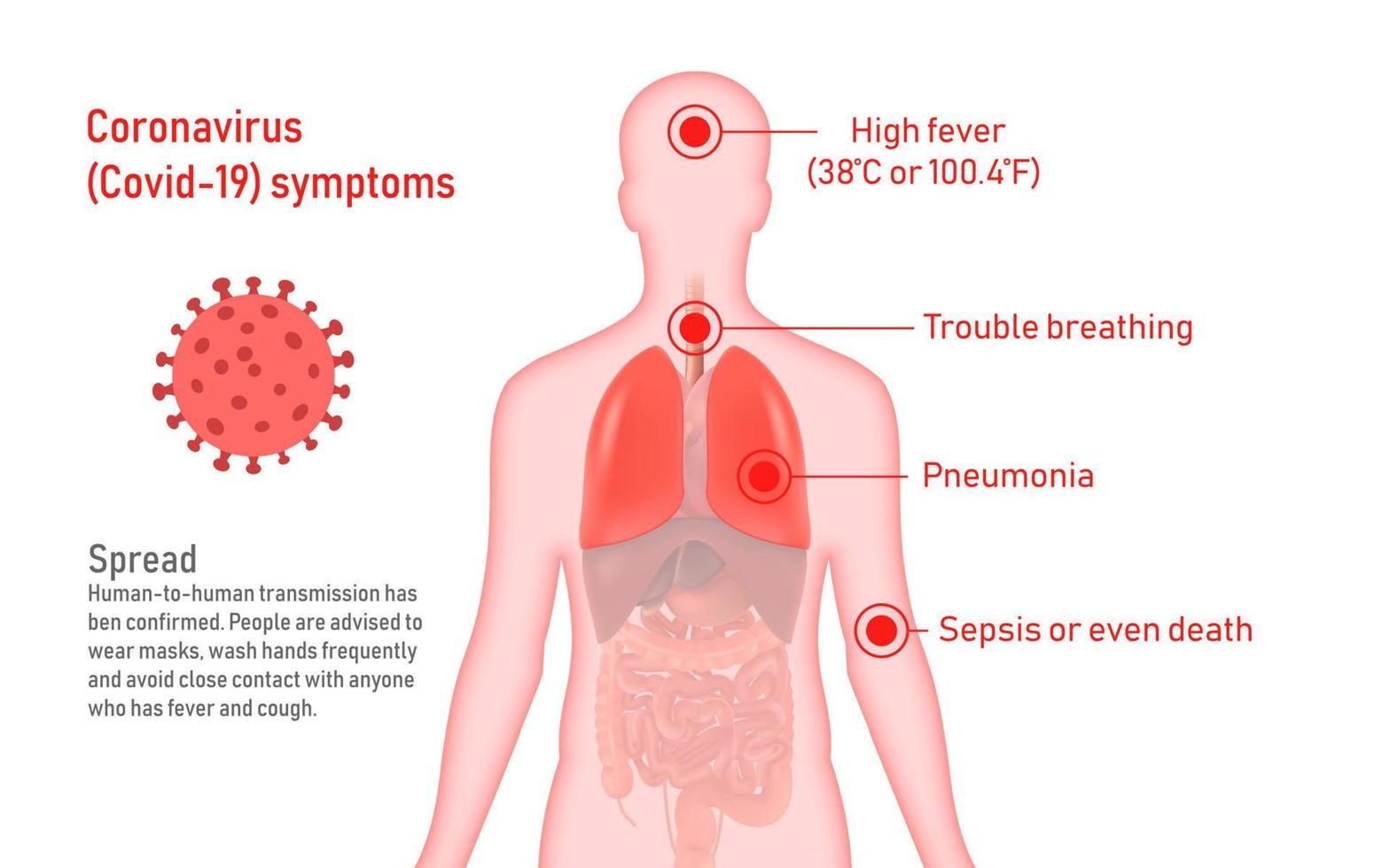 coronavirus cov infographics elementen, menselijk zijn tonen coronavirus symptomen en risico factoren. Gezondheid en medisch vector illustratie. covid 19 virus het uitbreken verspreiding.