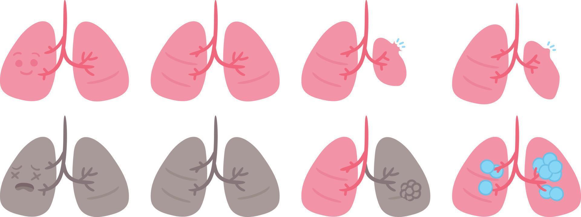 schattig menselijk orgaan long ziekte medisch anatomie tekenfilm karakter vector