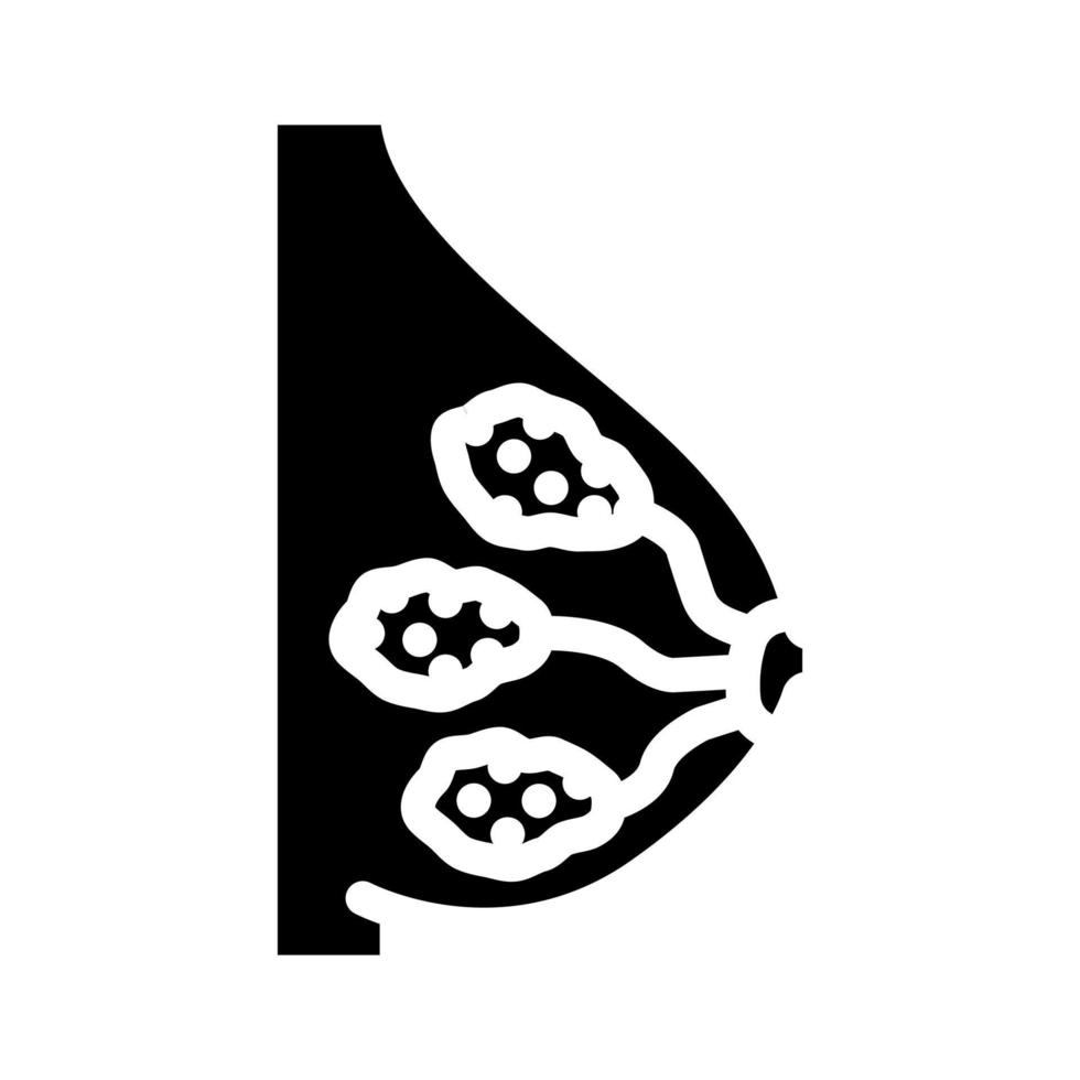 ductaal borst kanker glyph icoon vector illustratie