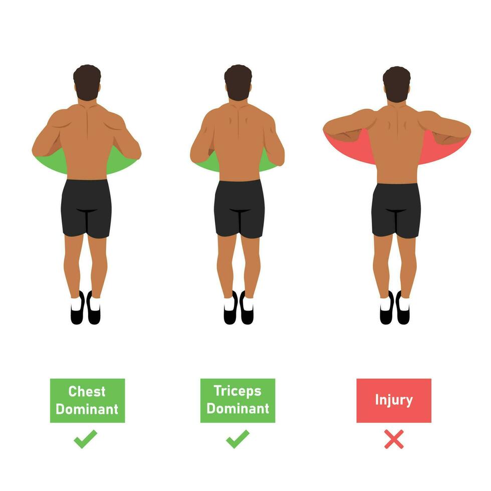 de Duwen omhoog dominant spier. hoe naar Doen Duwen omhoog van top visie. hand- positie. borst en triceps of letsel dominant. neutrale positie en intern rotatie. vlak vector illustratie geïsoleerd Aan wit