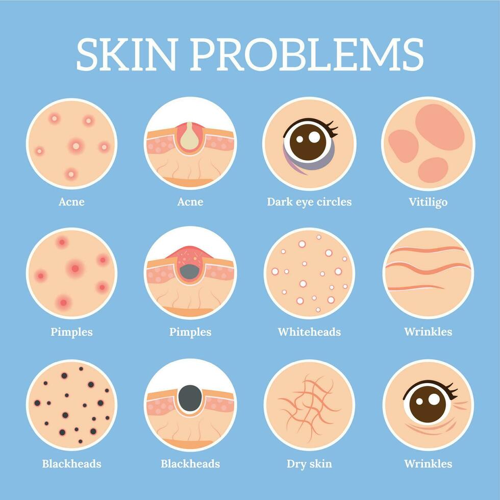huid problemen. leeftijden rimpels probleem, gezicht huid infectie behandeling en donker cirkels onder ogen vector pictogrammen reeks