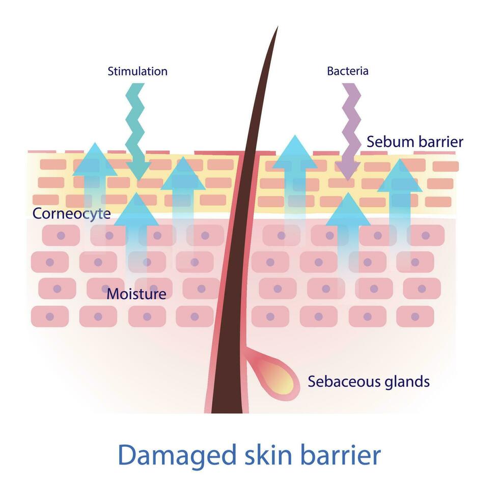 beschadigd huid barrière vector Aan wit achtergrond. de talg barrière verminderd, strak arrangement tussen de huid cellen is kwijt. huid zorg en schoonheid concept illustratie.