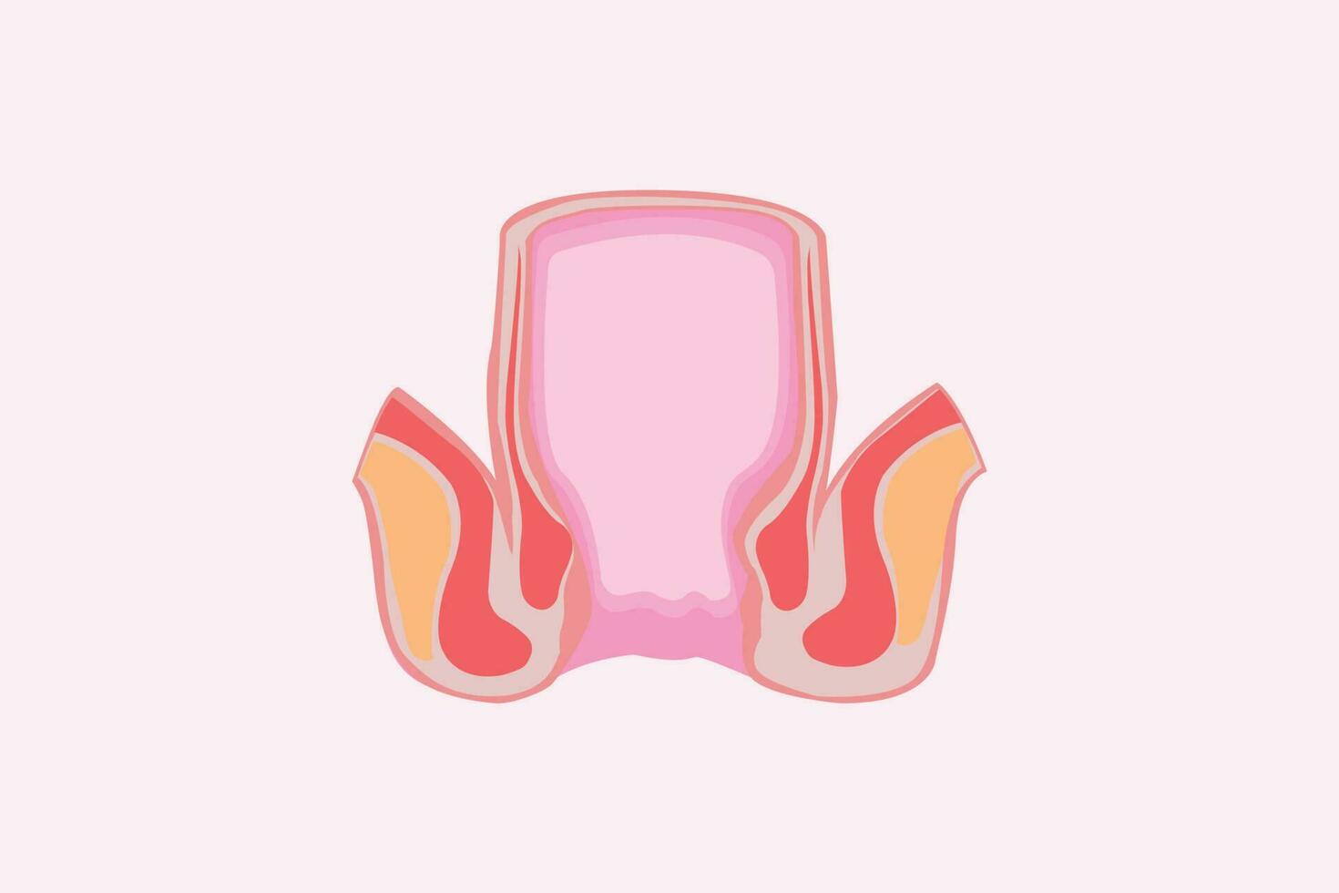 stapels. aambeien ziekte. vergelijking en verschillen tussen gezond rectum en een deel van een groot darm met intern en extern aambeien, pectinaat lijn en rectaal bloeden vector