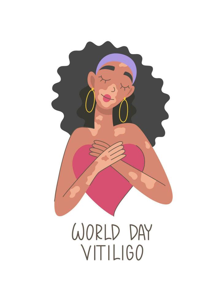 jong vrouw met vitiligo knuffels haar hart. schoonheid is verscheidenheid. zelfacceptatie, eigenliefde concept. adoptie. poster, banier, ansichtkaart wereld vitiligo dag vector