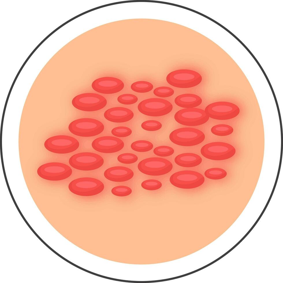 vlak stijl urticaria ziekte huid cirkel icoon. vector