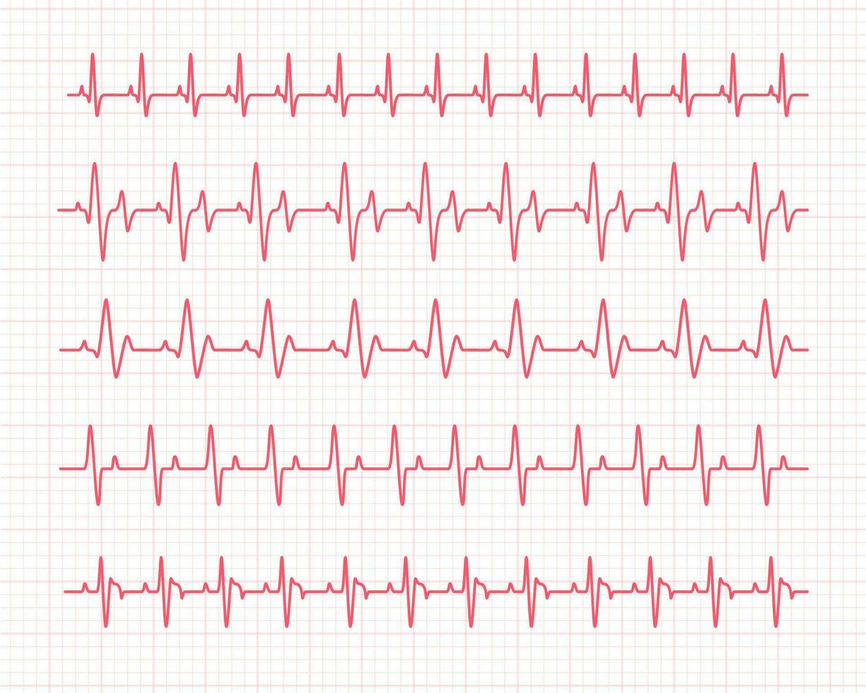 hart ritme diagram controle uw hartslag voor diagnose vector