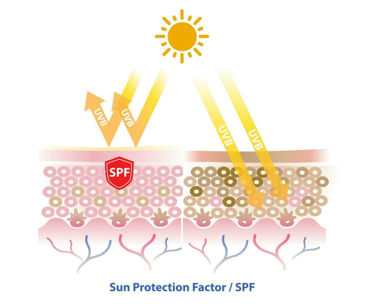 spf, zon bescherming factor blokken uvb straling doordringen in de huid laag vector Aan wit achtergrond. vergelijking van huid met zonnescherm en Nee zonnescherm. huid zorg en schoonheid concept illustratie.