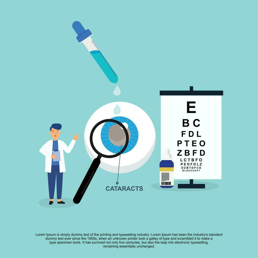 cataract vector illustratie in vlak stijl