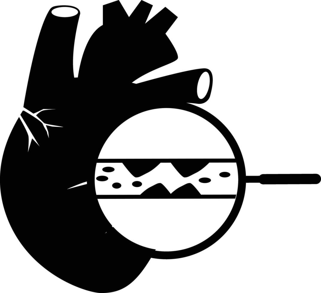 cholesterol in menselijk bloed schepen en hart icoon. hoog ldl teken. geblokkeerd slagaders symbool. hart aanval logo. hartspier infarct concept. vlak stijl. vector