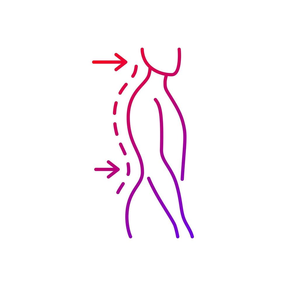 lumbale lordose gradiënt lineaire vector pictogram. overmatige binnenwaartse kromming van de wervelkolom. zadelrug. moeite met coördinatie. dunne lijn kleur symbolen. moderne stijlpictogram. vector geïsoleerde overzichtstekening