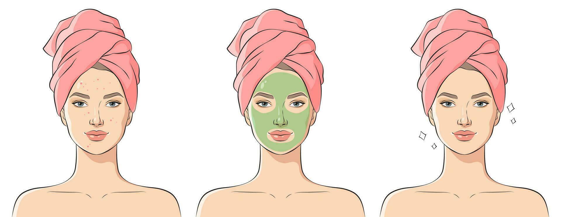 toepassen een kunstmatig masker Aan een gezicht met probleem huid. mooi jong vrouw met handdoek Aan haar hoofd, vector illustratie