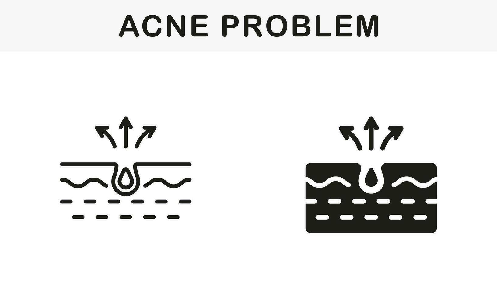 huid acne, puistje, comedo pictogram. vuil huid probleem symbool verzameling. mee-eter en ontsteking talg lijn en silhouet zwart icoon set. geïsoleerd vector illustratie.