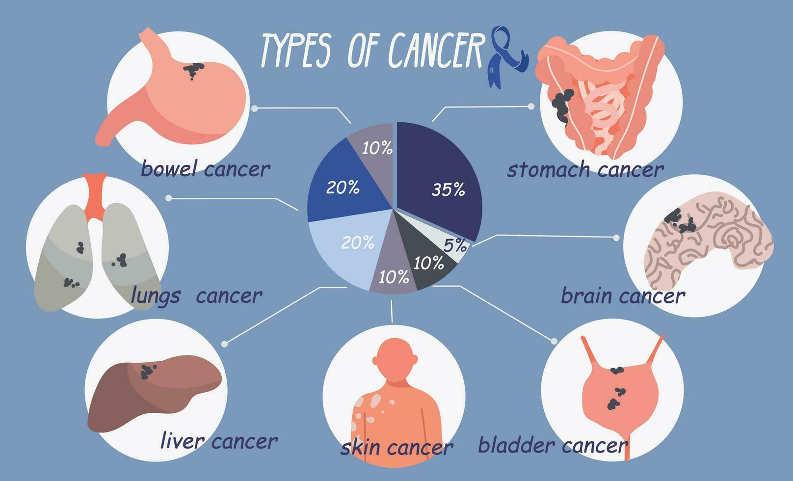 kanker types vlak infographics vector