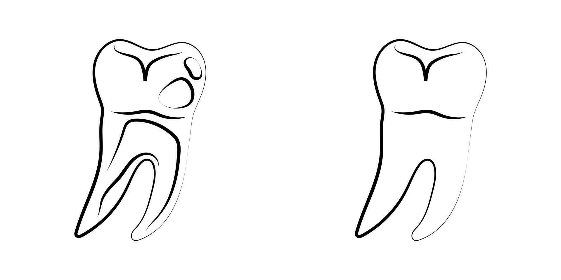 reeks van twee tanden lineair illustratie. vector logo, icoon voor tandheelkunde