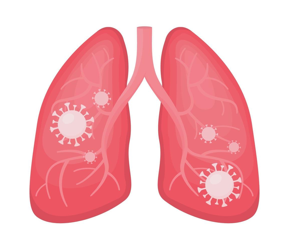 menselijke longen geïnfecteerde virale longontsteking en covid 19 vector