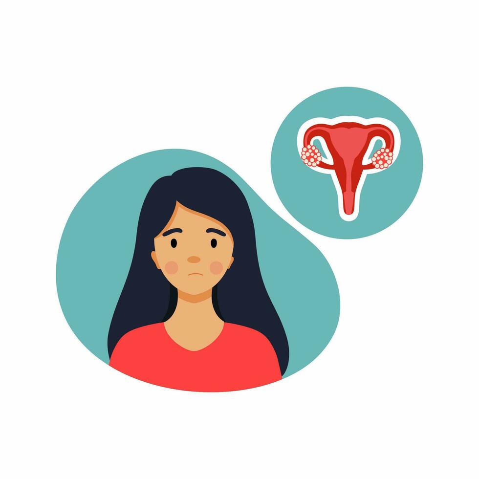 verdrietig vrouw met polycystisch eierstokken. illustratie Aan onderwerp van geneeskunde en Dames Gezondheid. problemen met menstruatie en ovulatie. zwangerschap en onvruchtbaarheid. vector
