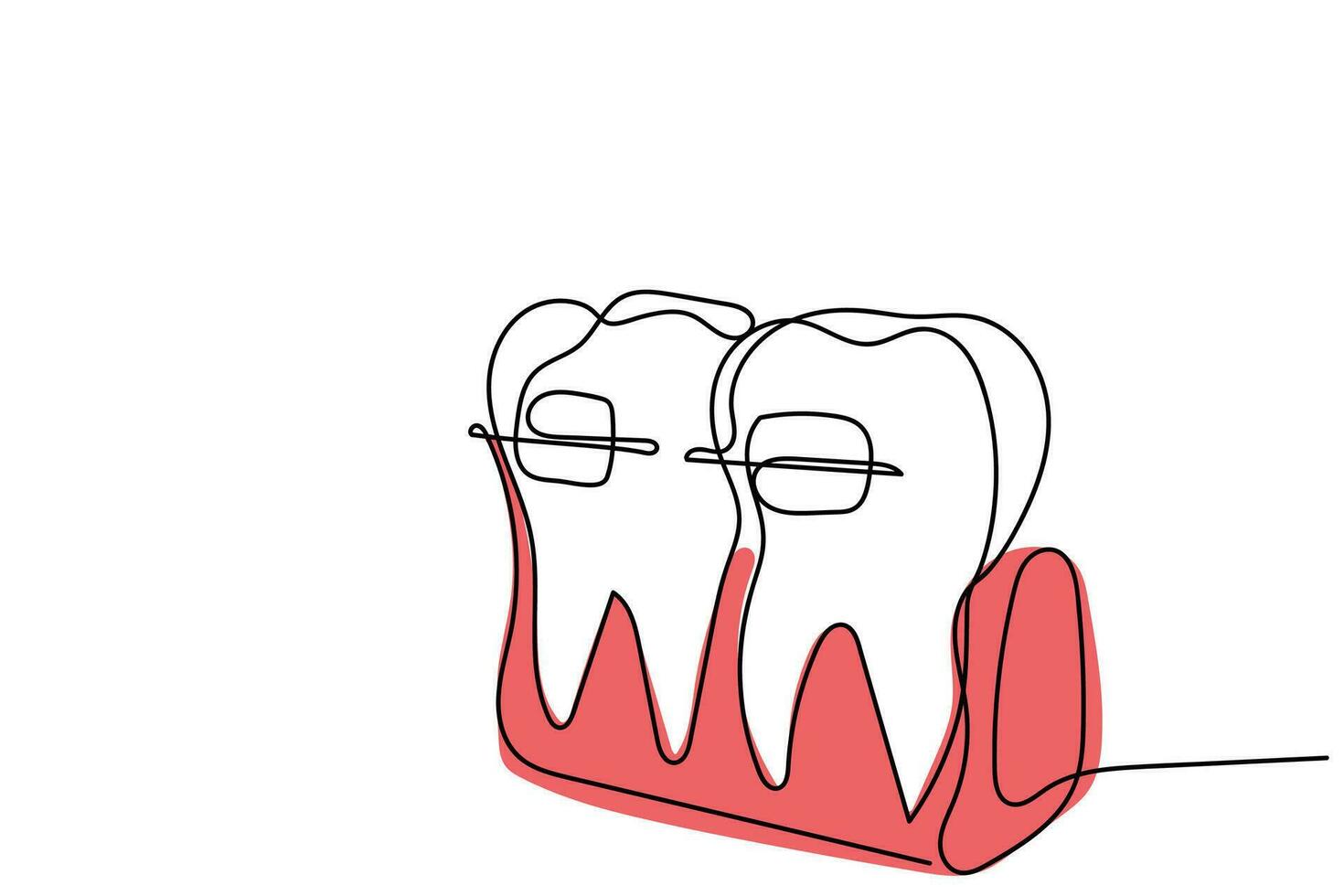 doorlopend lijn kunst van orthodontisch behandeling. tandartsen dag en respect voor hun Diensten naar de mensheid vector