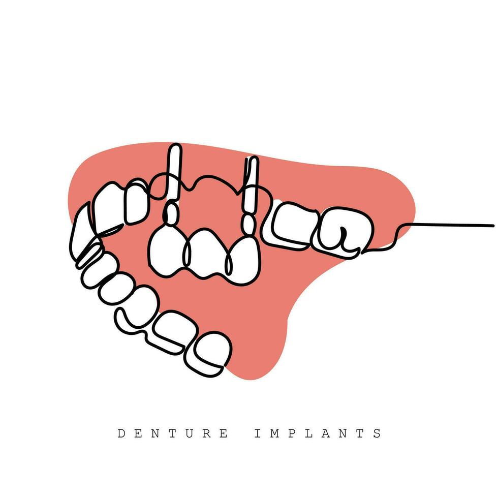 doorlopend lijn kunst van orthodontisch behandeling. tandartsen dag en respect voor hun Diensten naar de mensheid vector