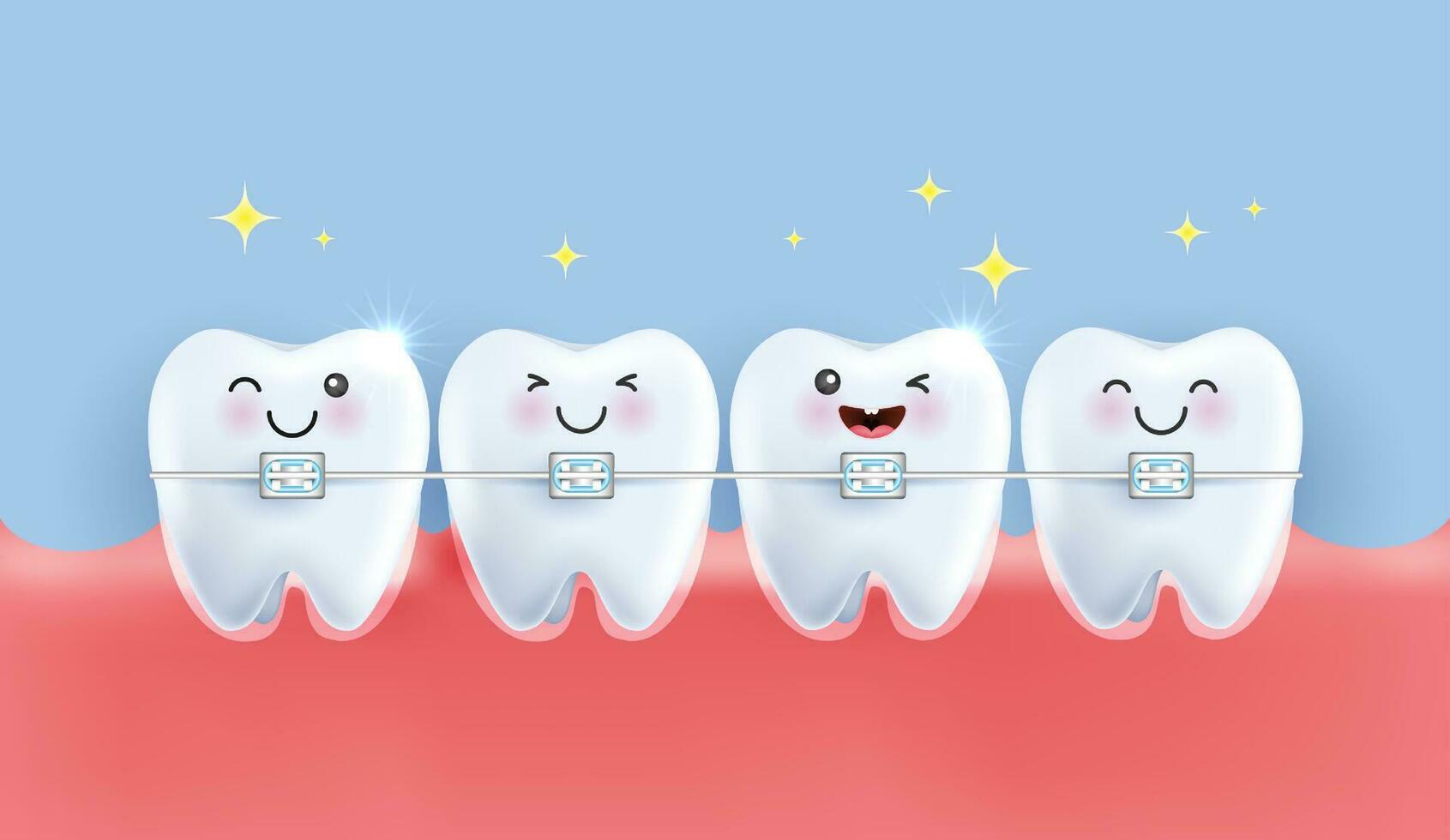 orthodontisch tandheelkunde. uitlijning van de beet van tanden, gebit met een beugel, tandheelkundig een beugel. gezond levensstijl en tandheelkundig zorg. medisch appjes, websites en ziekenhuis. vector. vector