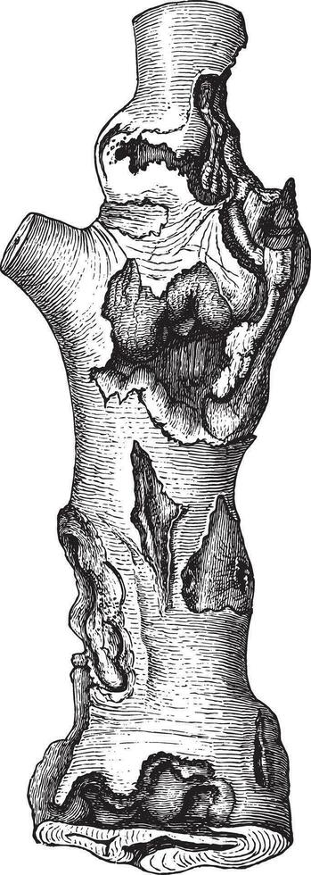 stam met veel beuken kanker, wijnoogst gravure. vector