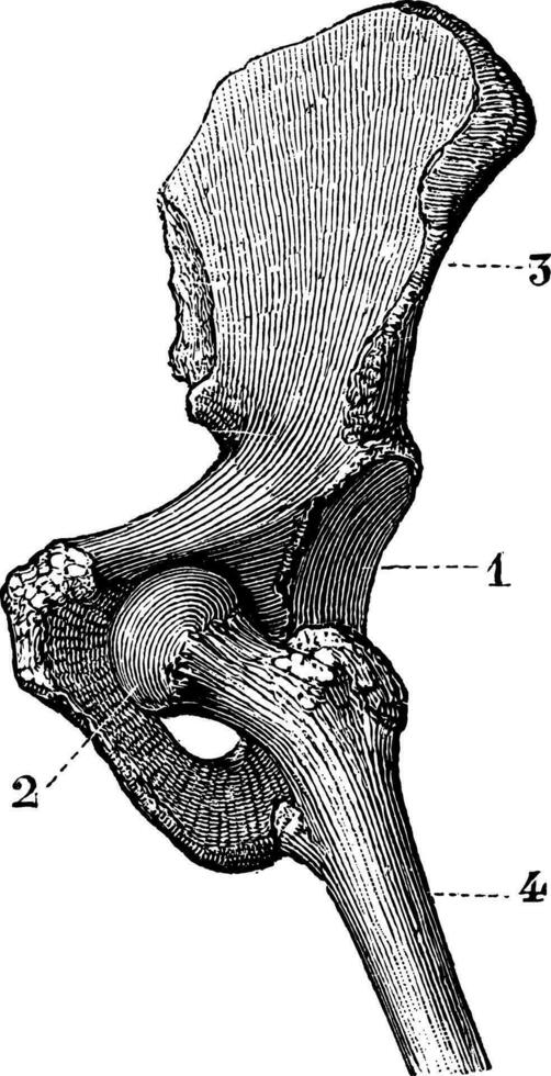 ischio-pubisch dislocatie of ovaal, wijnoogst gravure. vector