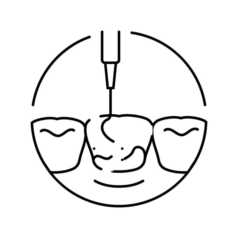 schalen tandheelkundig procedure lijn icoon vector illustratie