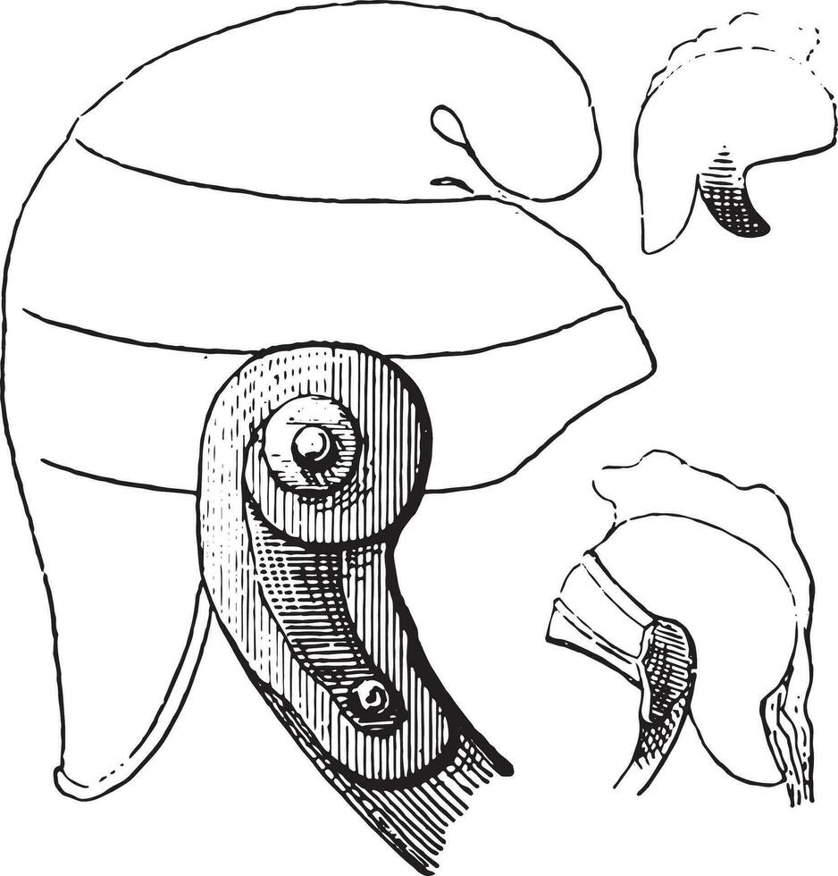 bof of epidemie parotitis, wijnoogst gravure. vector