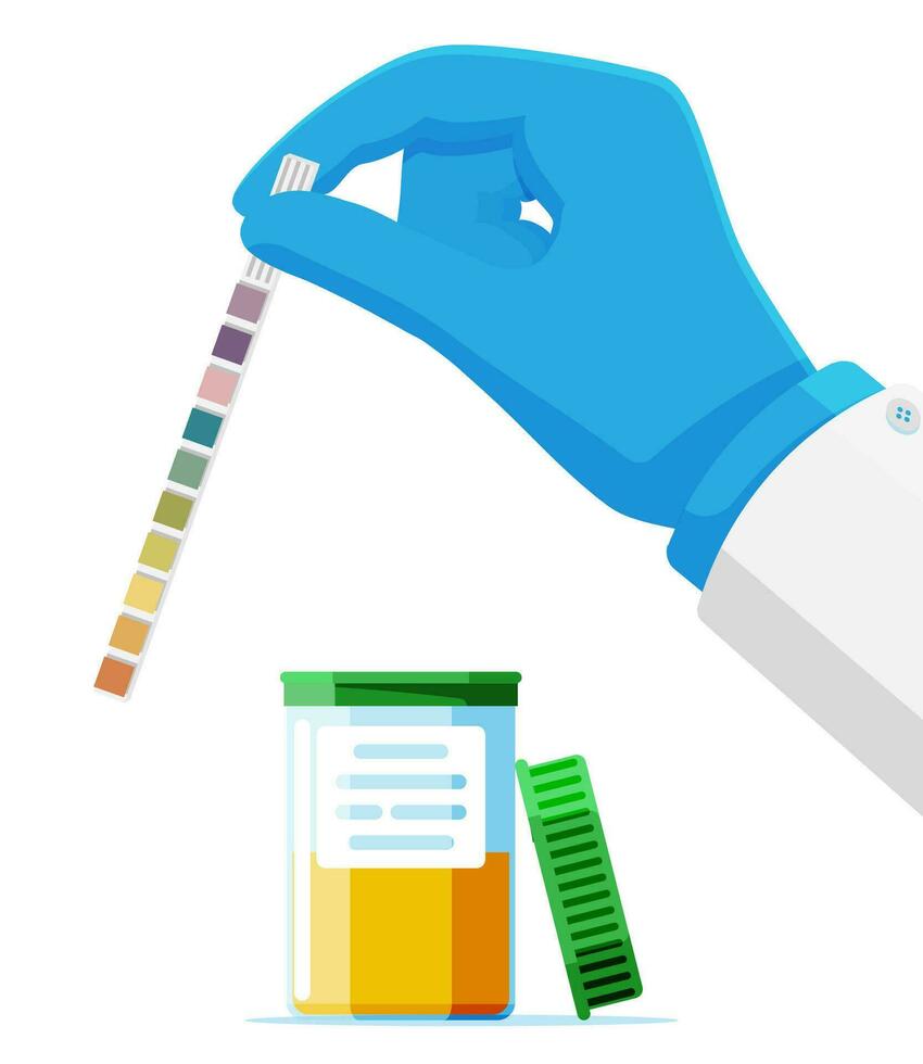 hand- van dokter Holding urine ph test strip in pot geïsoleerd. laboratorium urine test steekproef. diagnose urine- kanaal infectie. urologisch analyse en inspectie. vlak vector illustratie