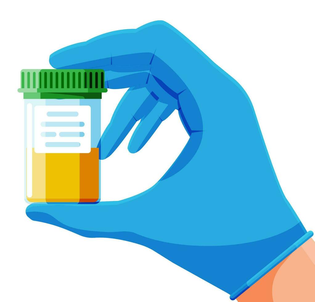 urine test buis in hand- geïsoleerd Aan wit. medisch monster in glas buis. laboratorium houder met urine. exemplaar kop voor urologisch analyse en medisch inspectie. tekenfilm vlak vector illustratie