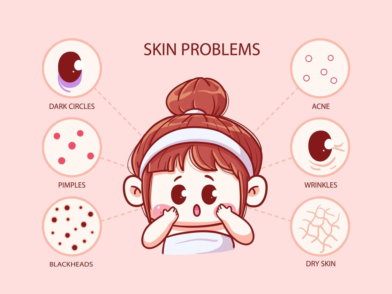 schattig en kawaii meisje met huidproblemen, donkere kringen, acne, puistjes, rimpels, mee-eters, droge huid, manga chibi illustratie vector