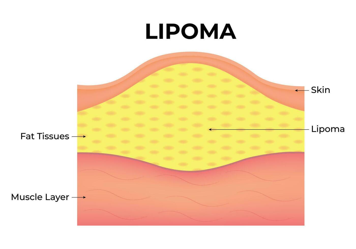 lipoom wetenschap ontwerp vector illustratie diagram