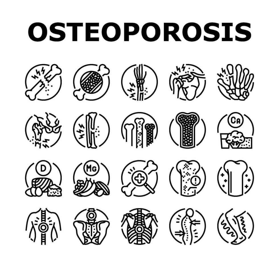 osteoporose bot pijn calcium pictogrammen reeks vector