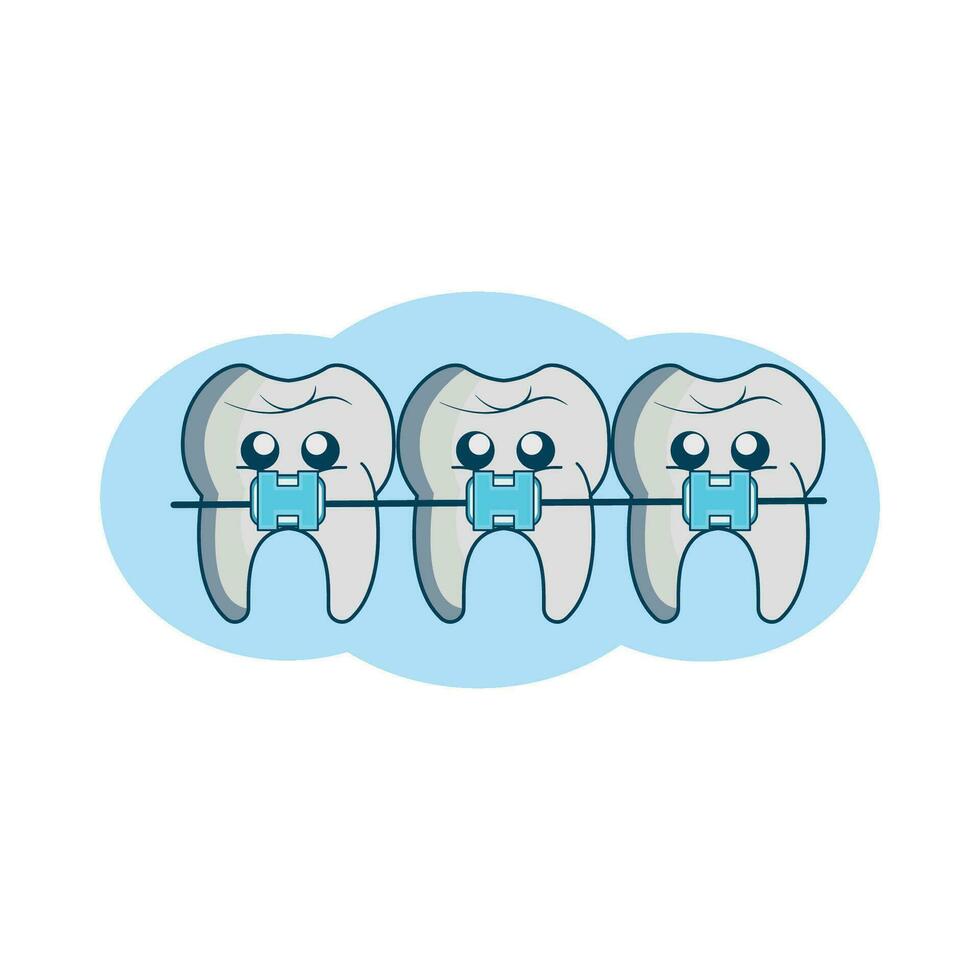 illustratie van tanden met een beugel vector