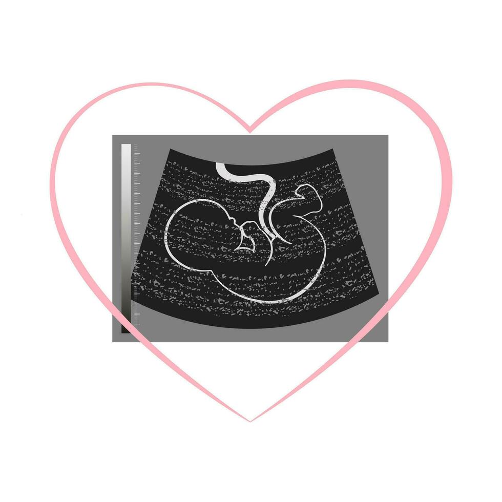 fotograaf van een echografie van een ongeboren baby embryo in een hart. illustratie, ansichtkaart, vector