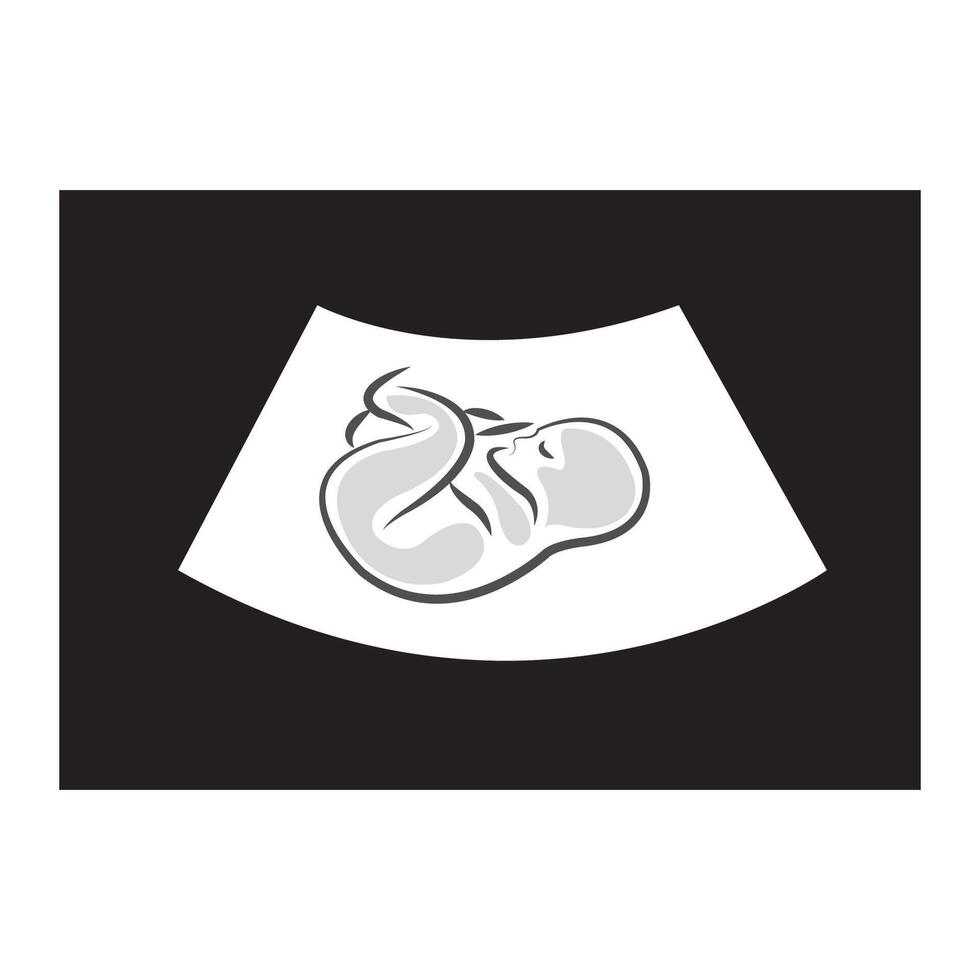 foetus icoon logo vector ontwerp sjabloon