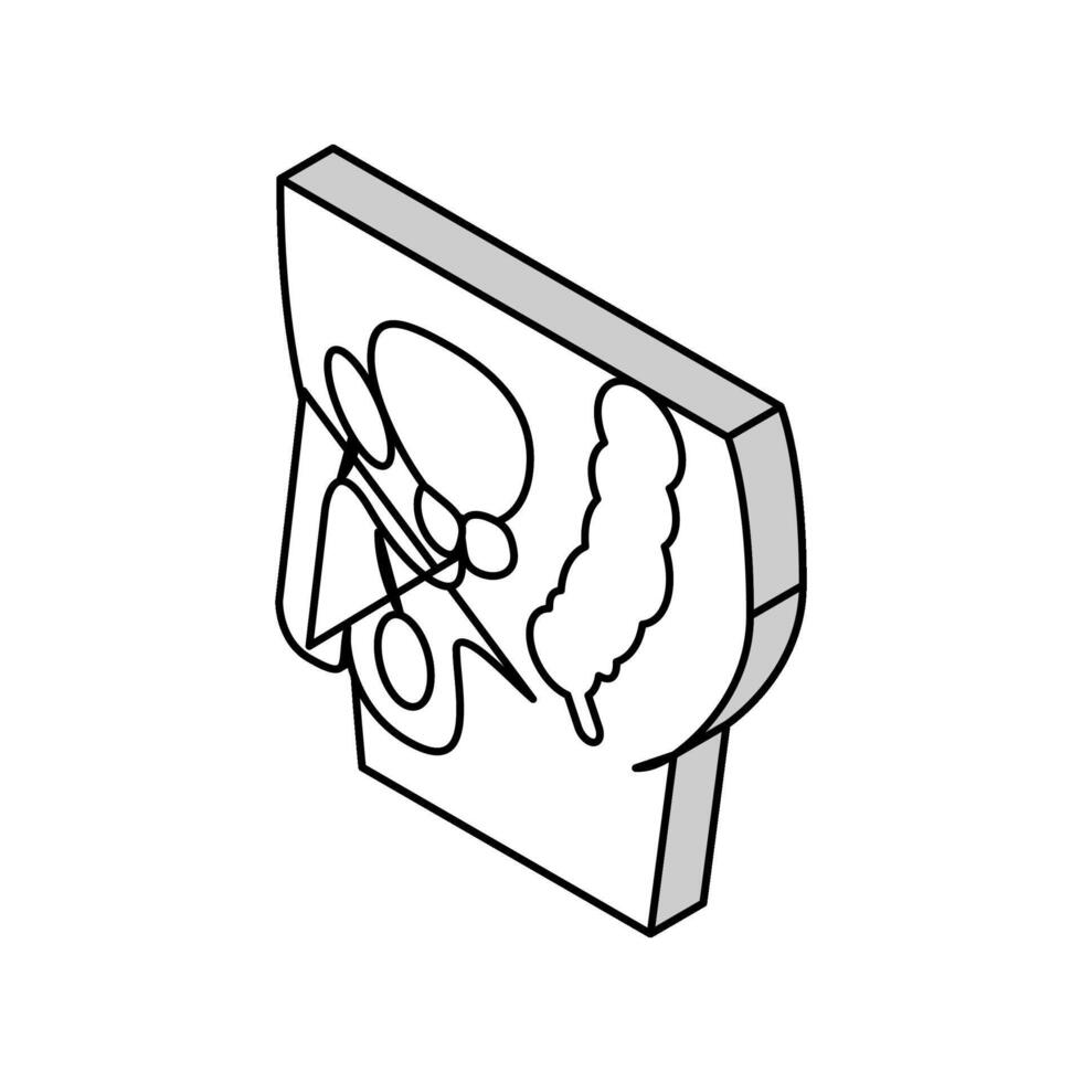 geduldig met prostaat isometrische icoon vector illustratie