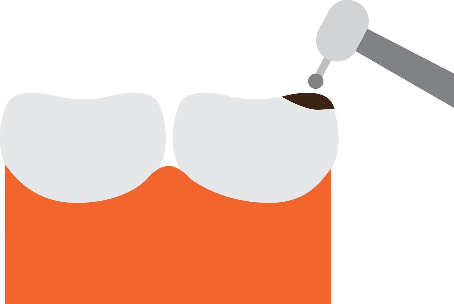 tandheelkundig holte concept.. glimlachen gezond tanden met verdrietig verval tand tekenfilm in vlak ontwerp vector