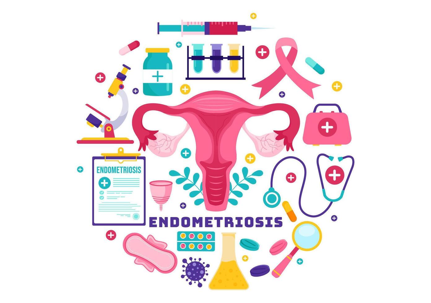 endometriose vector illustratie met staat de endometrium groeit buiten de baarmoeder muur in Dames voor behandeling in vlak tekenfilm achtergrond