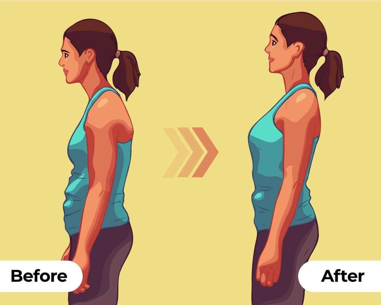vrouw lichaam posturaal veranderingen tonen vector illustraties