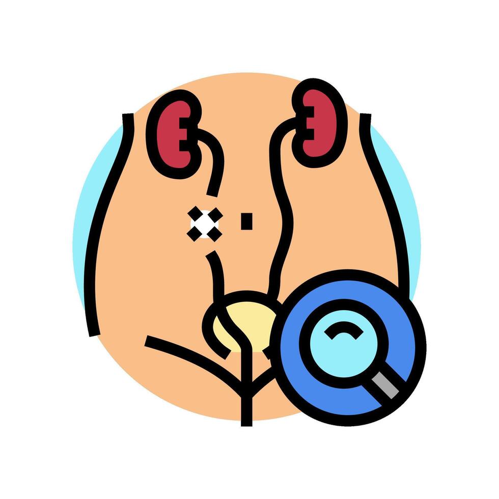 ureteroscopie chirurgie kleur icoon vector illustratie