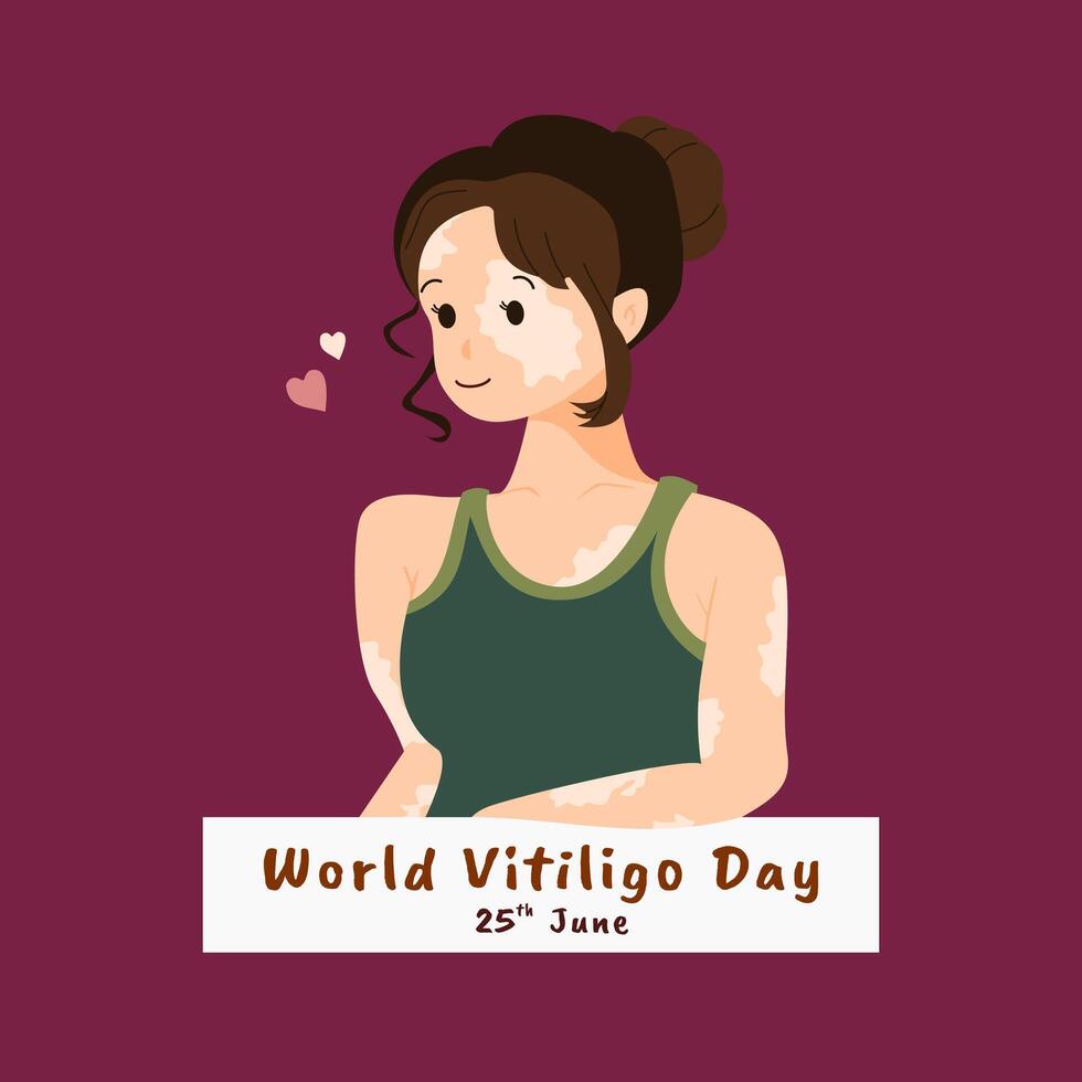 illustratie van een vrouw met haar haar- in een bun en vitiligo Aan haar eerlijk huid vector