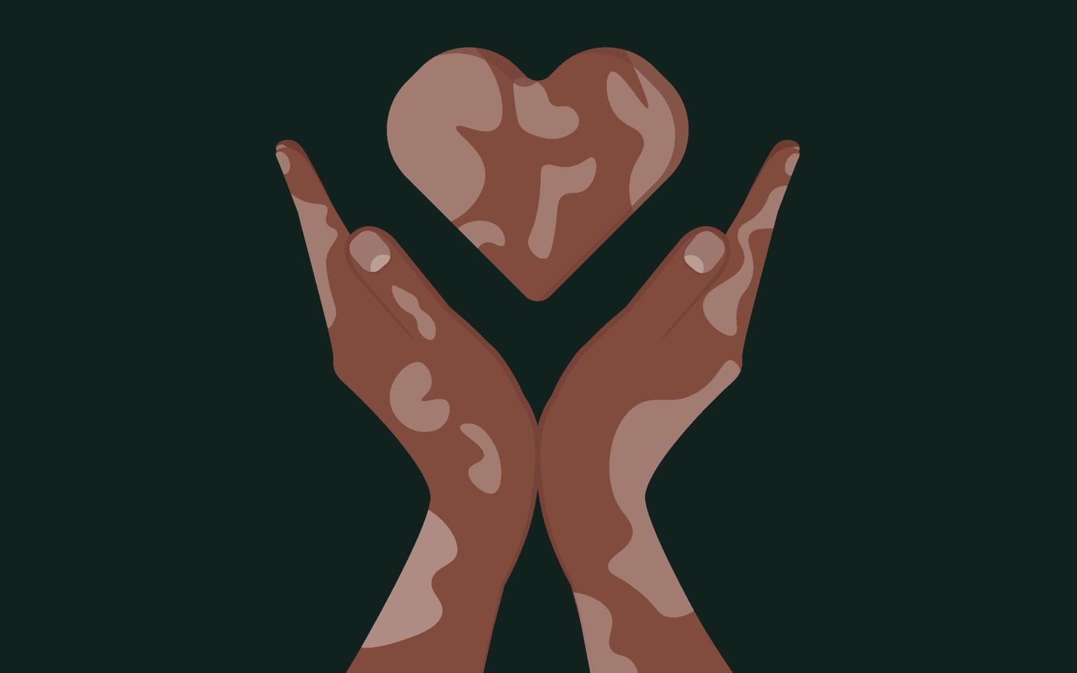 mensen met huidproblemen vitiligo. twee handen die een hartvormig gebaar maken. lichaam positief plat ontwerp van eigenliefde. depigmentatie ziekte. vector illustratie