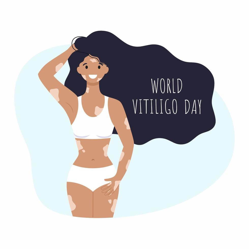 mooi meisje in een zwembroek en met vitiligo. de inscriptie wereld vitiligo dag op 25 juni. een vrouw heeft vitiligo. vectorillustratie op het gebied van zeldzame ziekten. vector