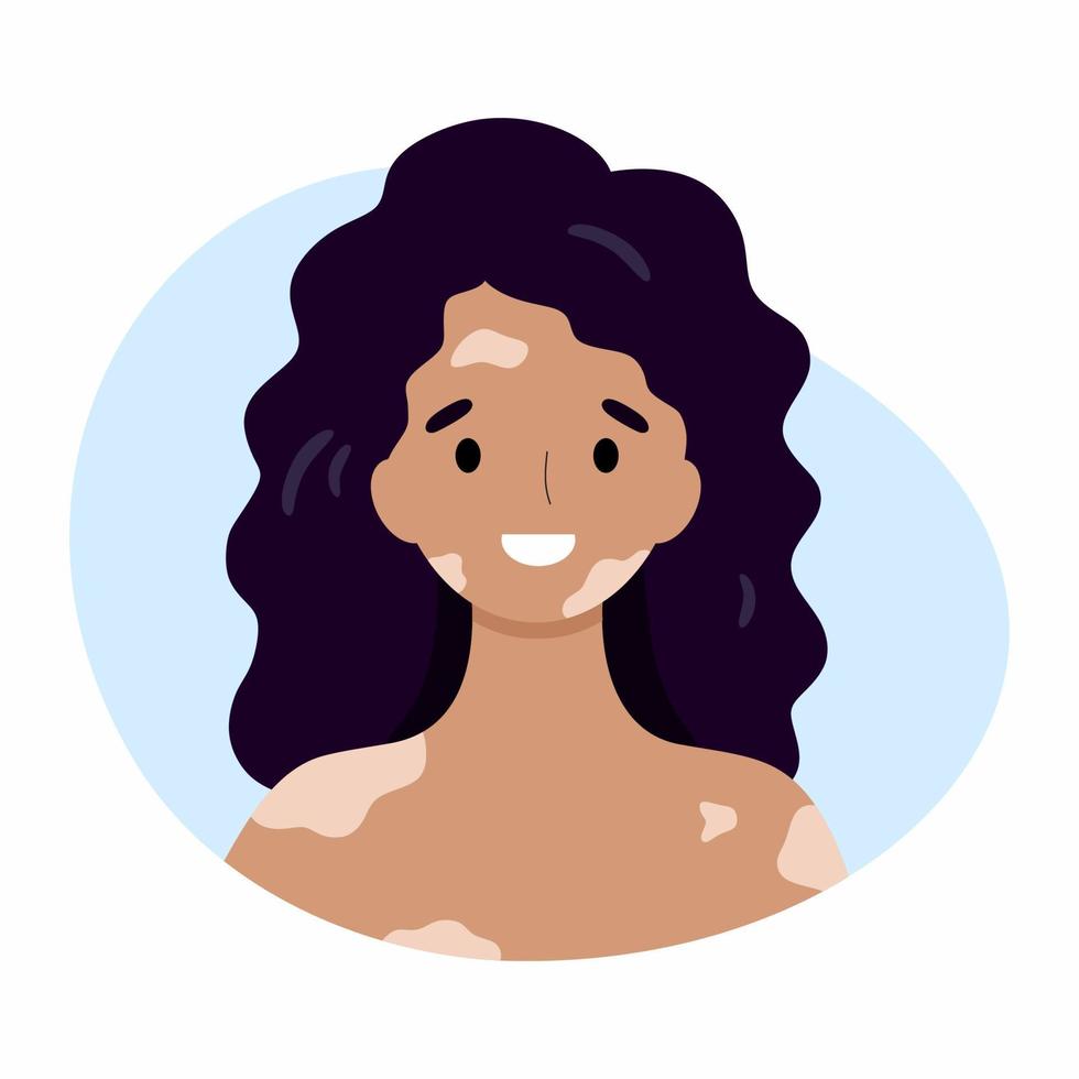 een gelukkige vrouw met vitiligo. het meisje heeft problemen met de huid van het gezicht en lichaam. vector