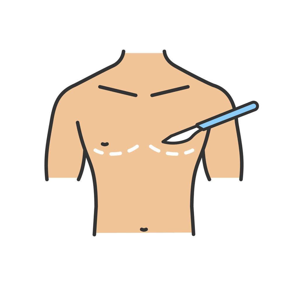 mannelijke borstoperatie kleur icoon. gynaecomastie. plastische chirurgie voor mannen. mannelijke borst contouren. geïsoleerde vectorillustratie vector