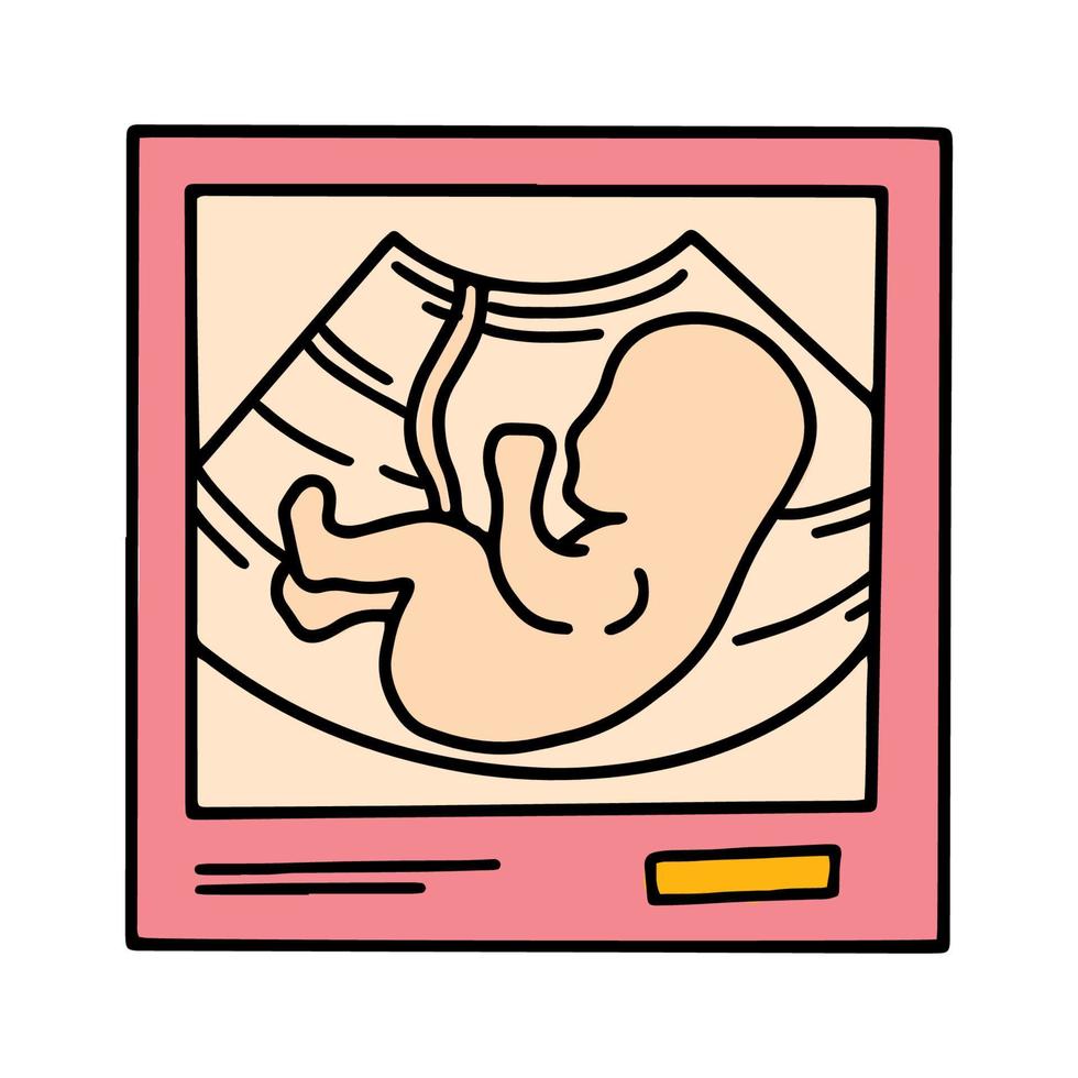 echografie afbeelding met een embryo baby, zwangerschap scan geïsoleerde roze pictogram in cartoon stijl vector