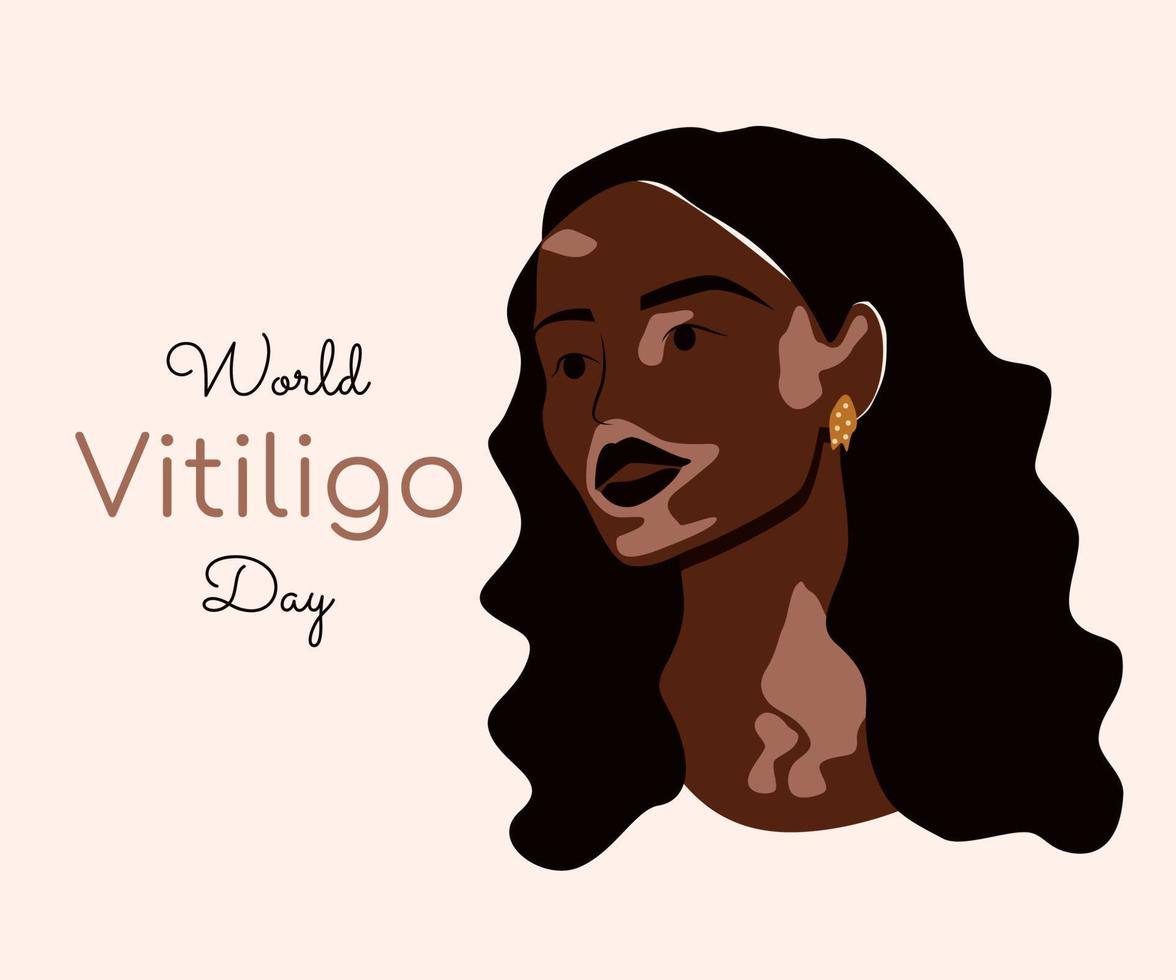 jonge Afro-Amerikaanse vrouw leeft met vitiligo. verschillende schoonheid, zelfliefde en huidziekte concept. wereld vitiligo dag. platte vectorillustratie geïsoleerd op beige background vector