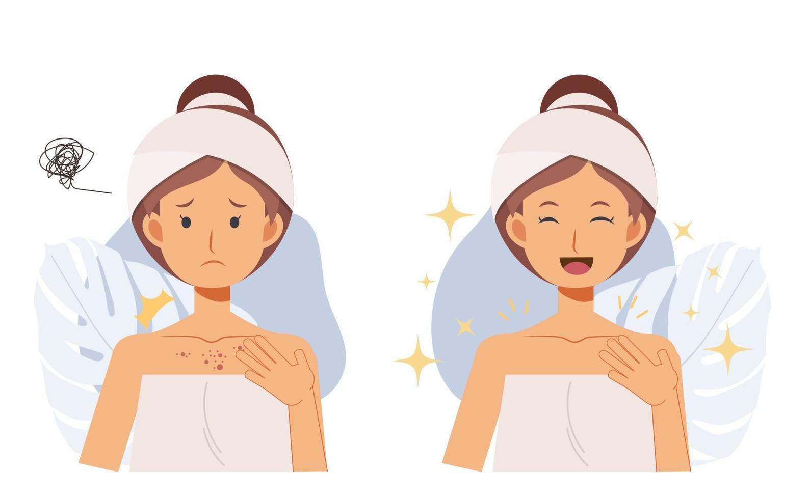 huidverzorging concept.acne behandeling. vrouw met acne op haar borst, voor en na. platte vectorcartoob-tekenillustratie vector